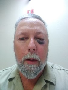 My Shiner.jpg